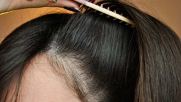 Una receta mágica para hacer que el cabello fino sea grueso, grueso, fuerte y largo en 2 días. Mejor solución para el cabello