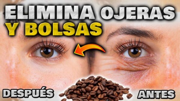 Elimina Ojeras, Bolsas y Arrugas al Instante con este Tratamiento Anti-Ojeras Natural ¡Descubre el Secreto!
